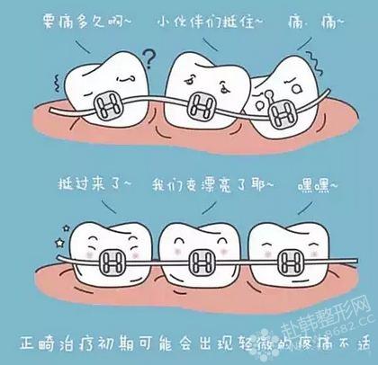 牙齿矫正后反弹怎么办?如何预防?